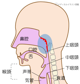 慢性上咽頭炎(Ｂスポット療法・EAT療法)